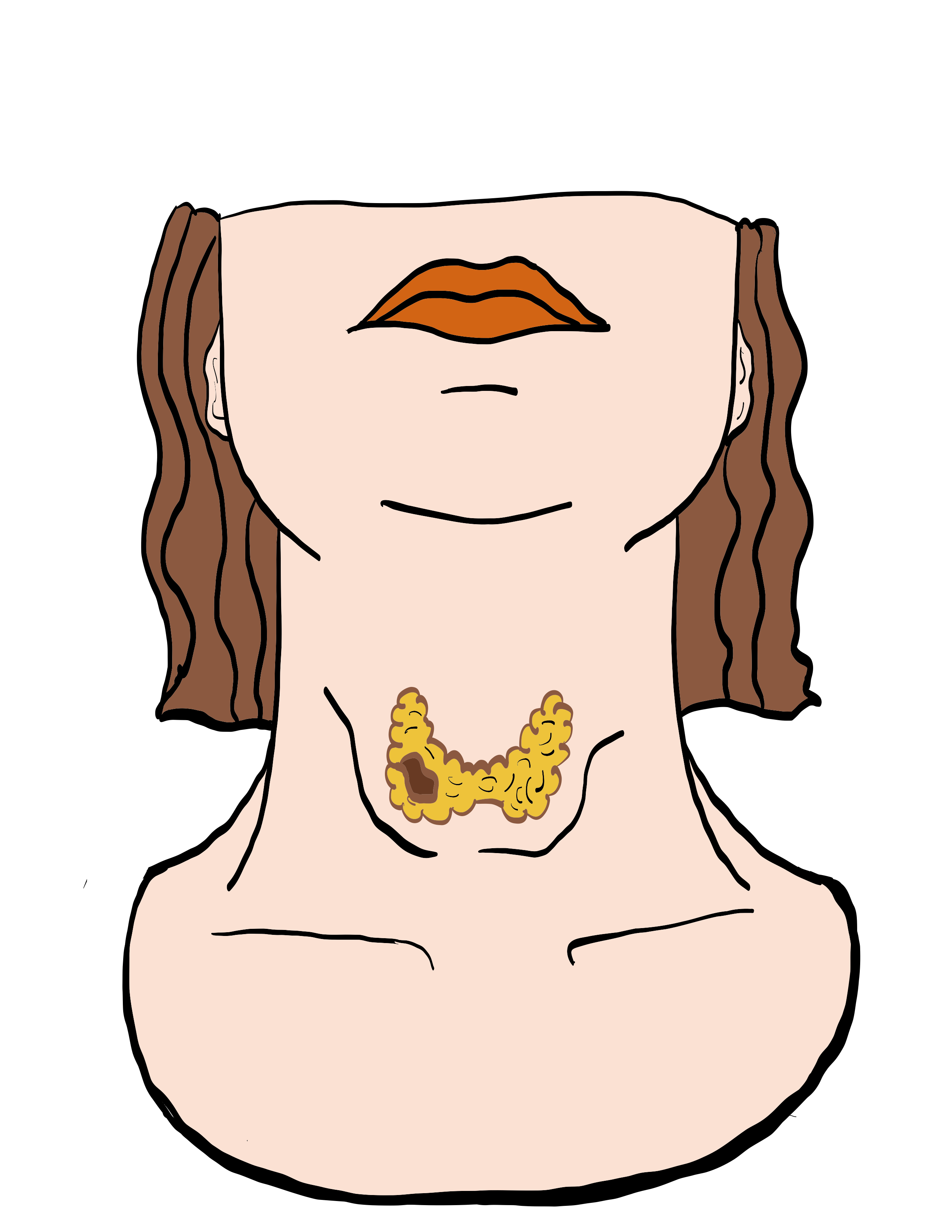 tratamiento-para-la-tiroides